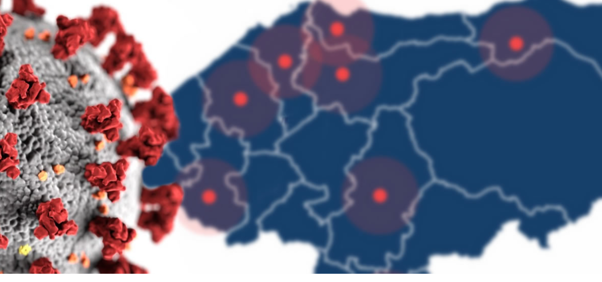 Muere por COVID-19 un paciente en el Hospital San Francisco de Juticalpa, departamento de Olancho. Muere por COVID-19 un paciente en el Hospital San Francisco de Juticalpa, departamento de Olancho.