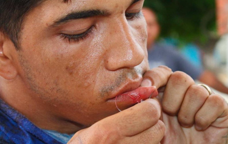 Migrantes suturan sus labios como protesta afuera de conferencia de AMLO en Chiapas