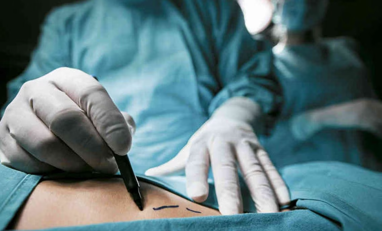 Mujer murió en cirugía de aumento de glúteos casera, a manos de amiga que no estaba calificada