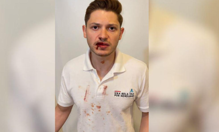 Colectivos de Libre agreden físicamente a Rashid Mejía