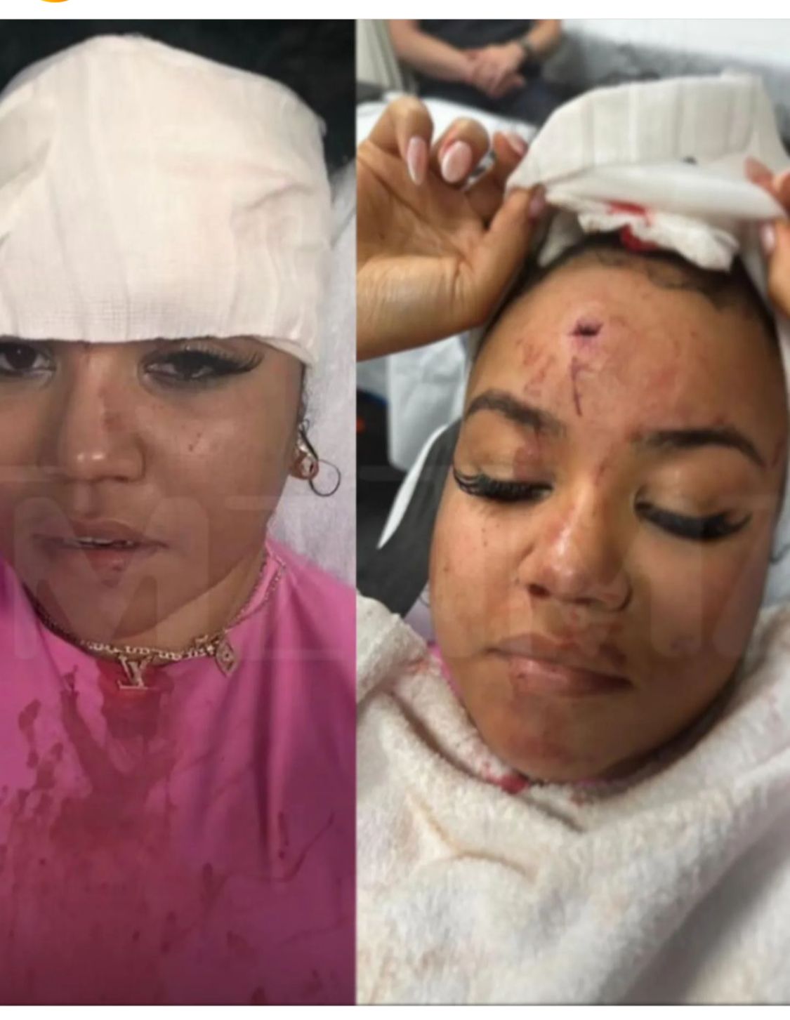 El rapero 50 cents arroja micrófono al público y le parte la frente a una fan