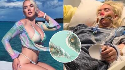 Amputan pierna de mujer de Georgia tras infectarse de bacteria «come carne»