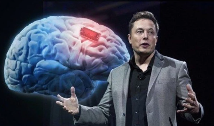Elon Musk ya está reclutando voluntarios para implantar los chips cerebrales de Neuralink Elon Musk ya está reclutando voluntarios para implantar los chips cerebrales de Neuralink