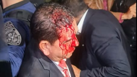 Colectivos del Partido LIBRE atacan diputados de oposición en el Congreso Nacional