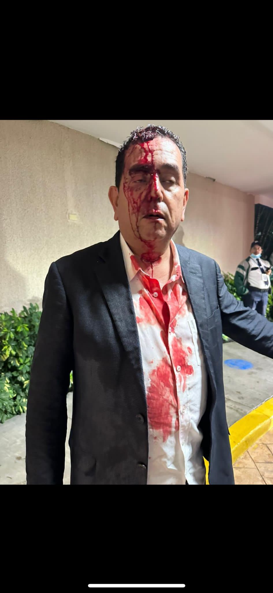 ¡Zafarrancho! Agreden al Diputado Nacionalista “Toño Rivera”