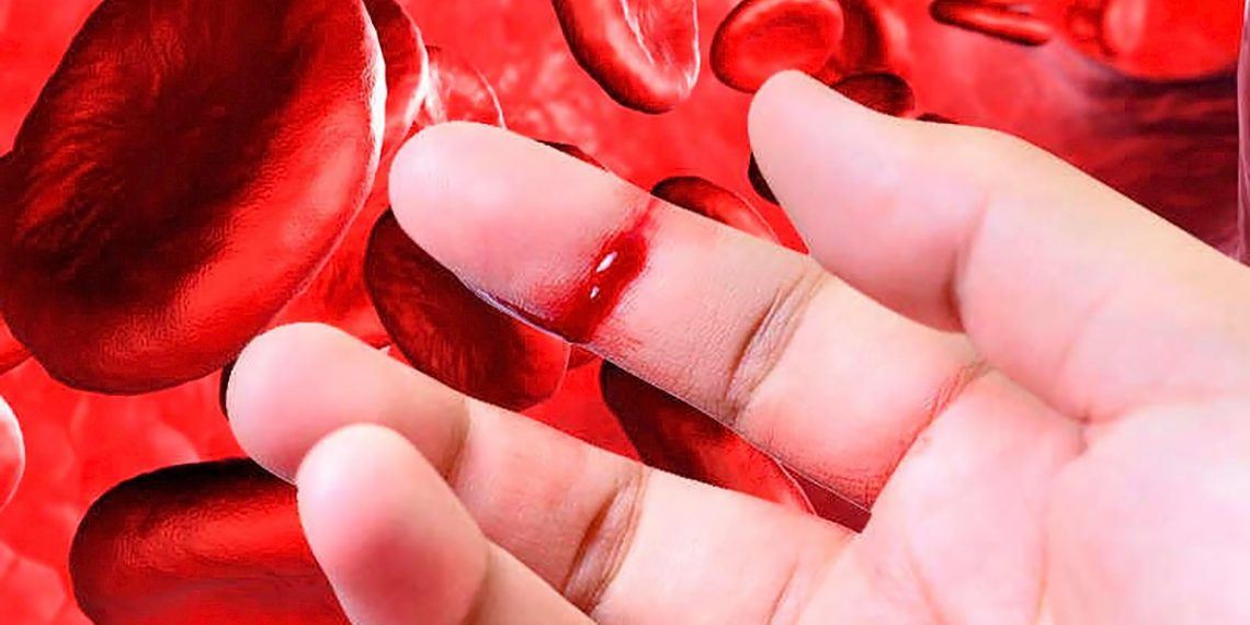 Día Mundial de la Hemofilia