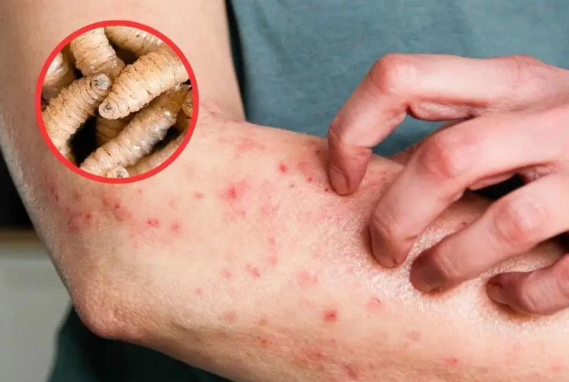 Honduras registra cuatro muertos y 125 casos de gusano barrenador en humanos